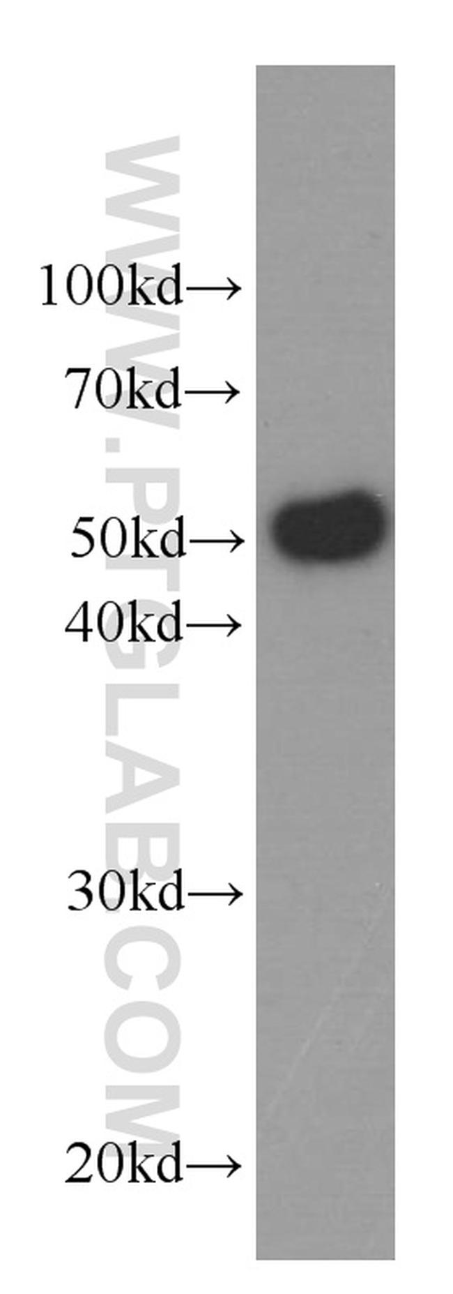 Antithrombin III Antibody in Western Blot (WB)