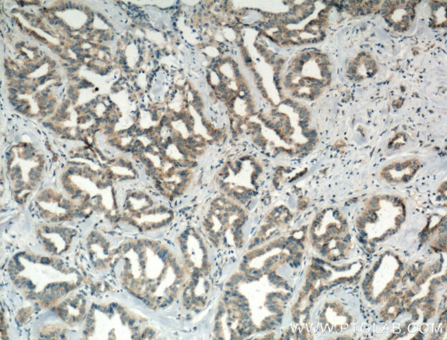 PA2G4 Antibody in Immunohistochemistry (Paraffin) (IHC (P))