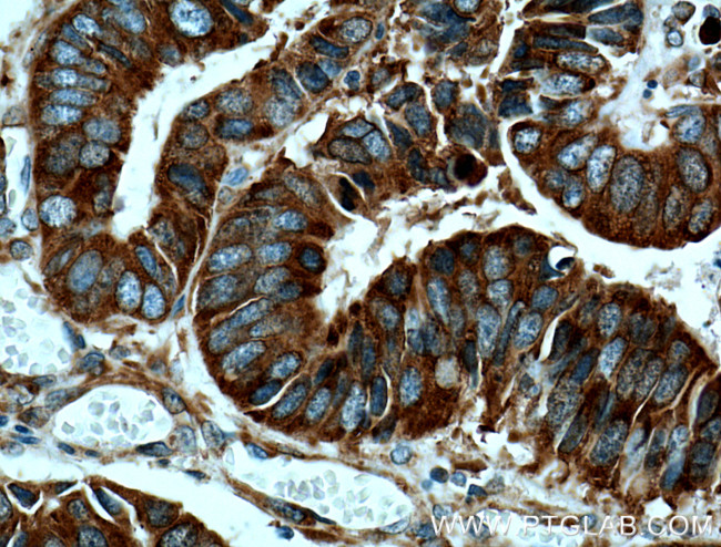 RACGAP1 Antibody in Immunohistochemistry (Paraffin) (IHC (P))