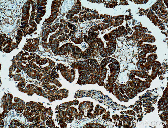 RACGAP1 Antibody in Immunohistochemistry (Paraffin) (IHC (P))