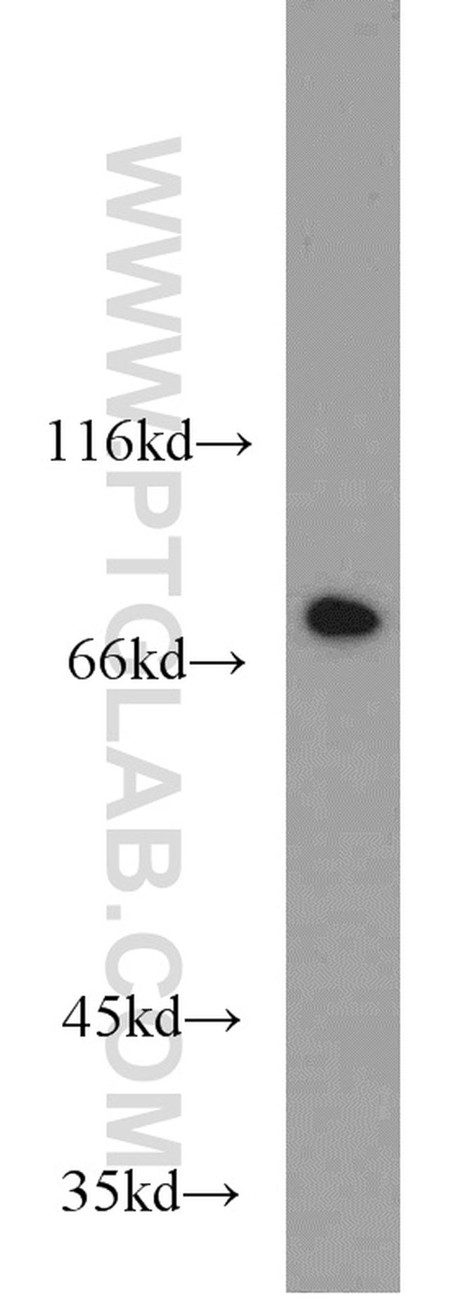 RACGAP1 Antibody in Western Blot (WB)