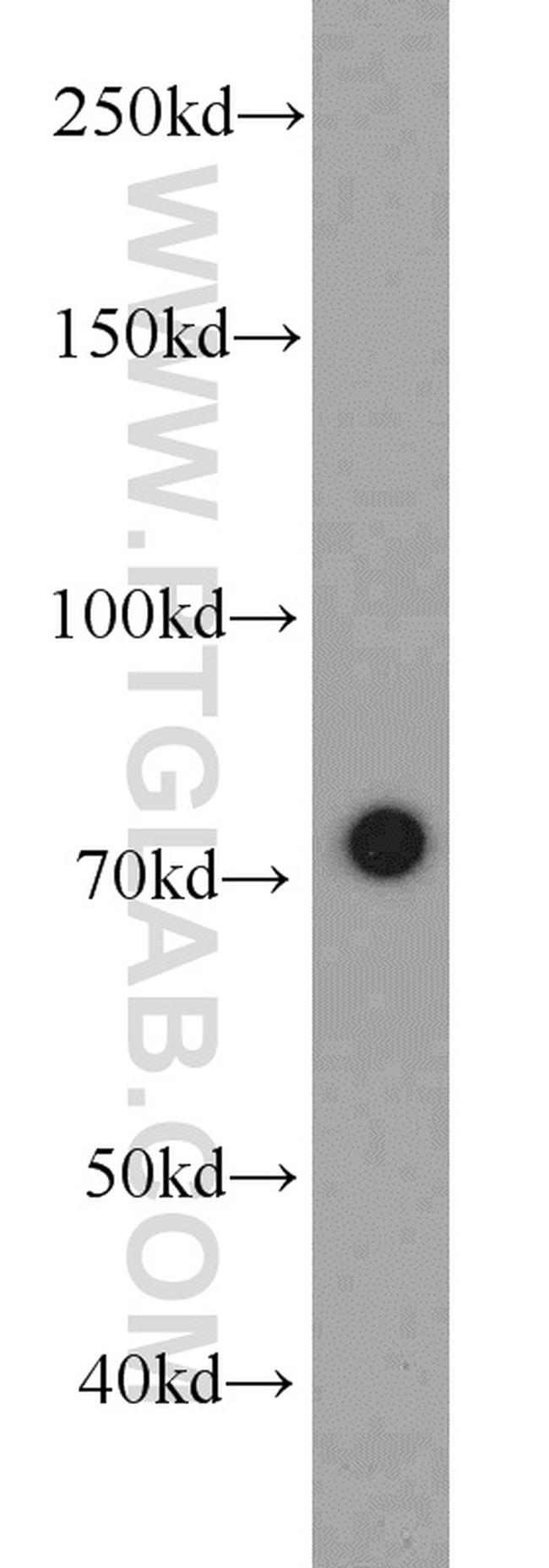 RACGAP1 Antibody in Western Blot (WB)