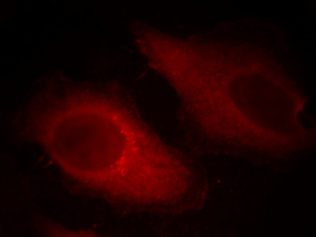 Cofilin Antibody in Immunocytochemistry (ICC/IF)