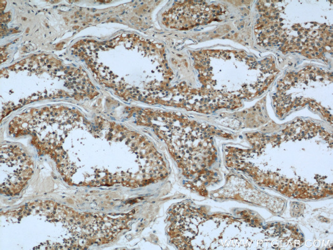 Cofilin Antibody in Immunohistochemistry (Paraffin) (IHC (P))