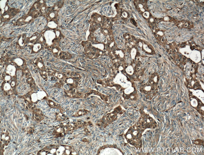 Cofilin Antibody in Immunohistochemistry (Paraffin) (IHC (P))