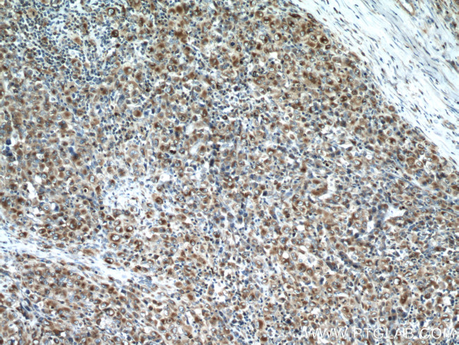 RAB27A Antibody in Immunohistochemistry (Paraffin) (IHC (P))