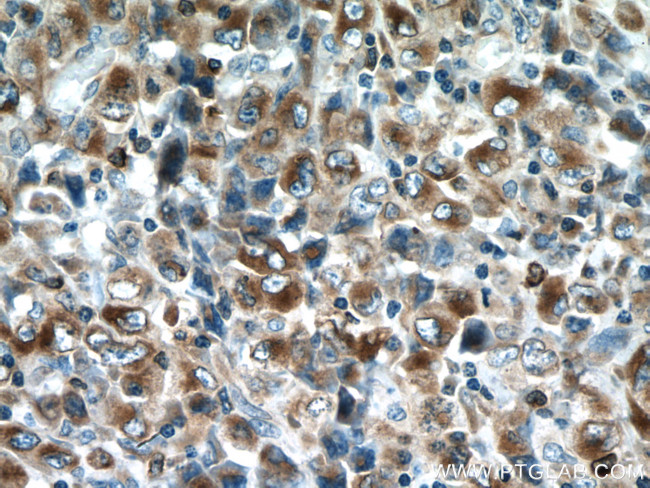 RAB27A Antibody in Immunohistochemistry (Paraffin) (IHC (P))