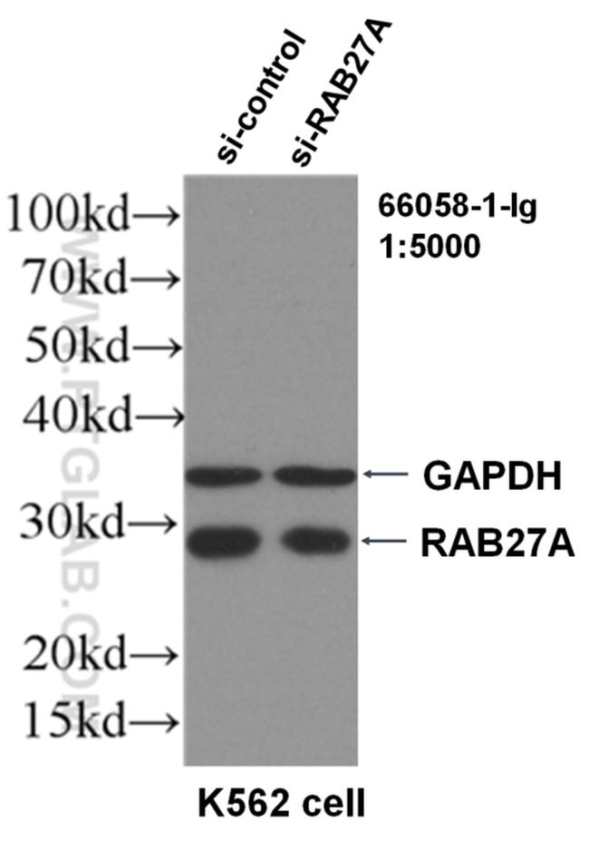 RAB27A Antibody in Western Blot (WB)