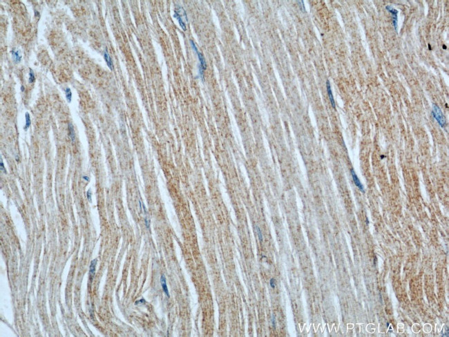 RAB27A Antibody in Immunohistochemistry (Paraffin) (IHC (P))