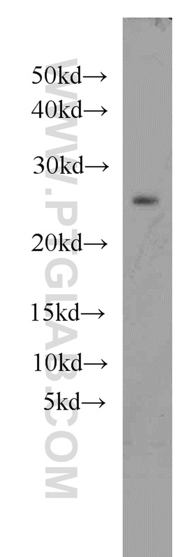 RAB27A Antibody in Western Blot (WB)