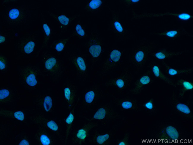 RBM15 Antibody in Immunocytochemistry (ICC/IF)