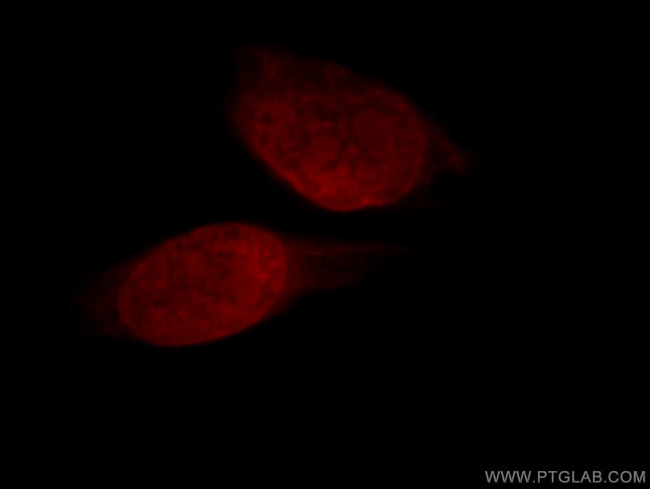 RBM15 Antibody in Immunocytochemistry (ICC/IF)