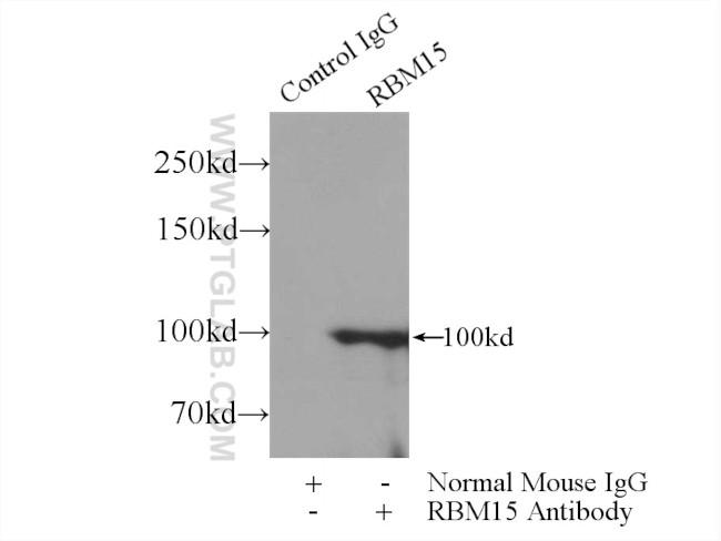 RBM15 Antibody in Immunoprecipitation (IP)