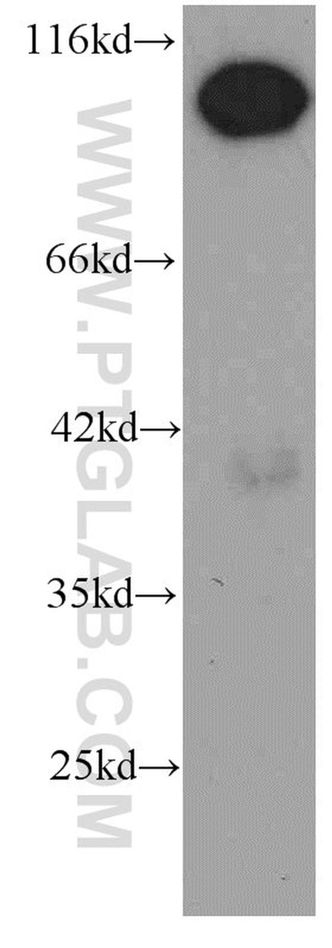 RBM15 Antibody in Western Blot (WB)