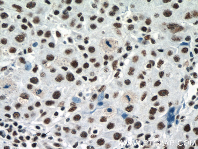 RBM15 Antibody in Immunohistochemistry (Paraffin) (IHC (P))