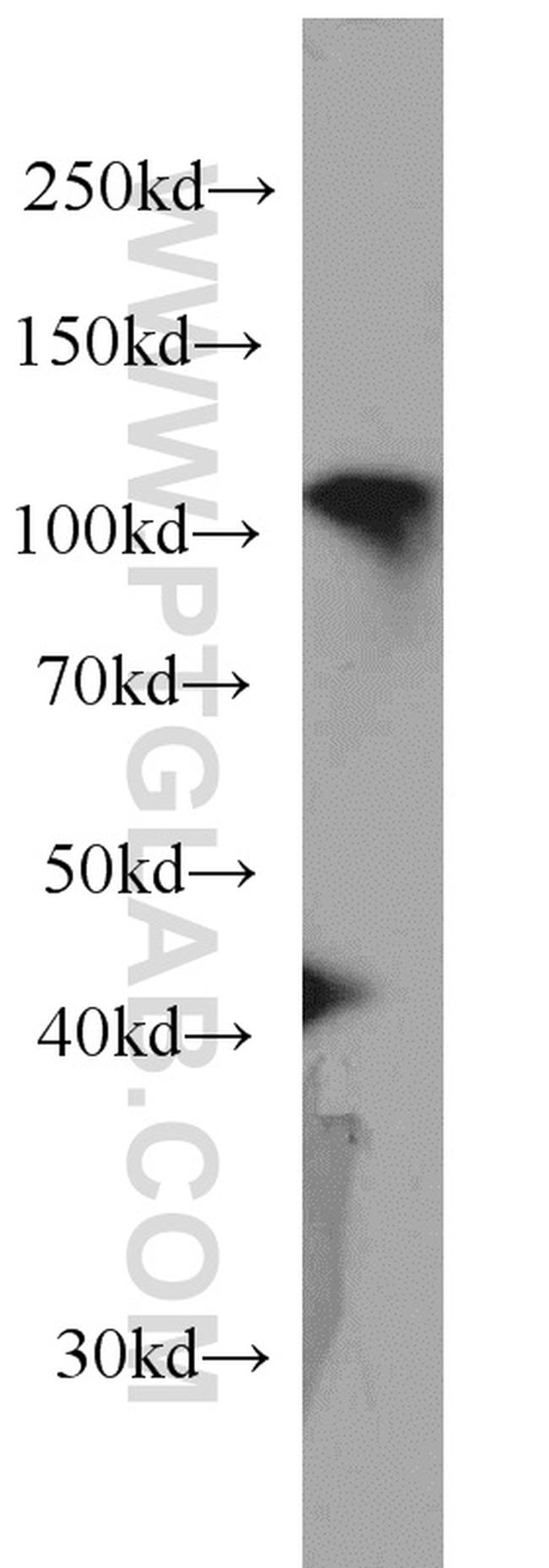 RBM15 Antibody in Western Blot (WB)