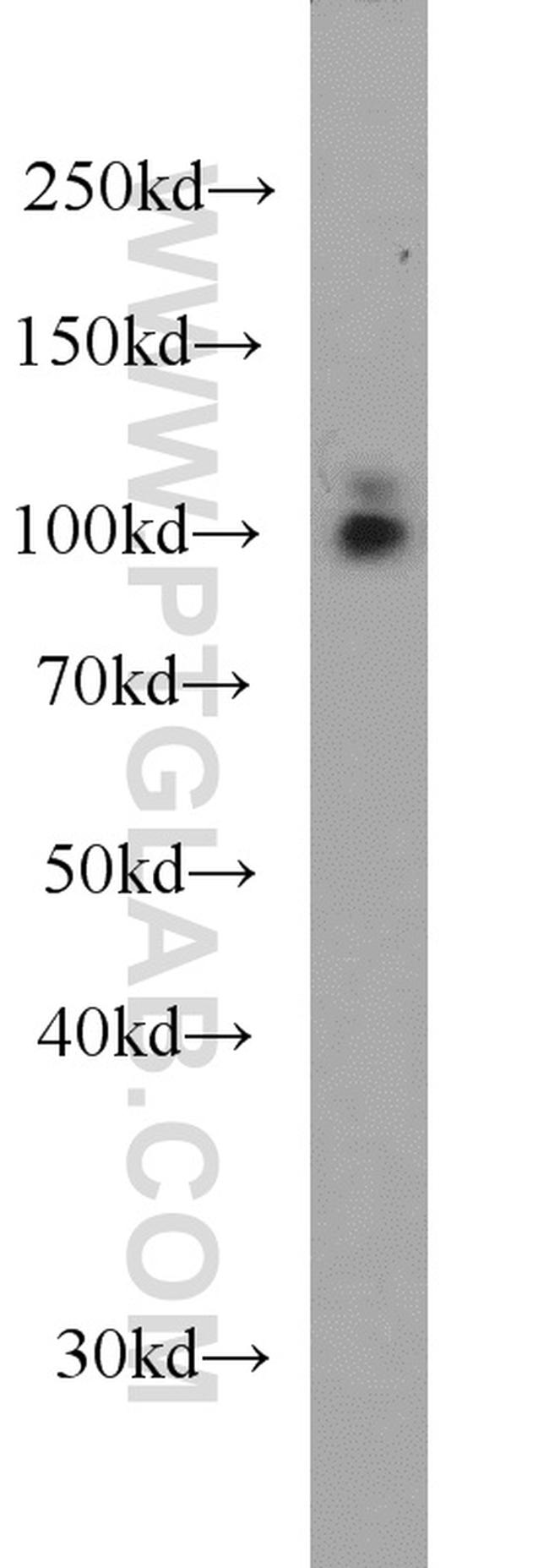 RBM15 Antibody in Western Blot (WB)