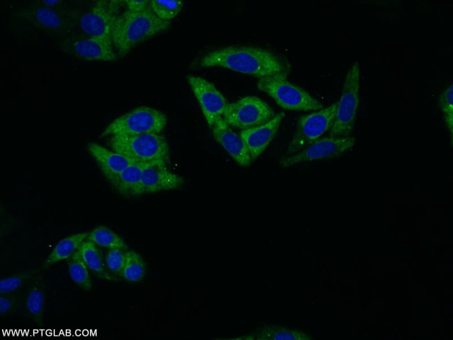 14-3-3 Antibody in Immunocytochemistry (ICC/IF)