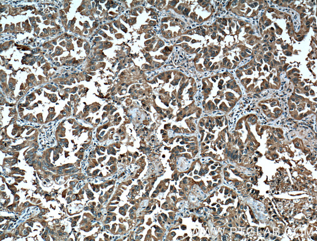 14-3-3 Antibody in Immunohistochemistry (Paraffin) (IHC (P))