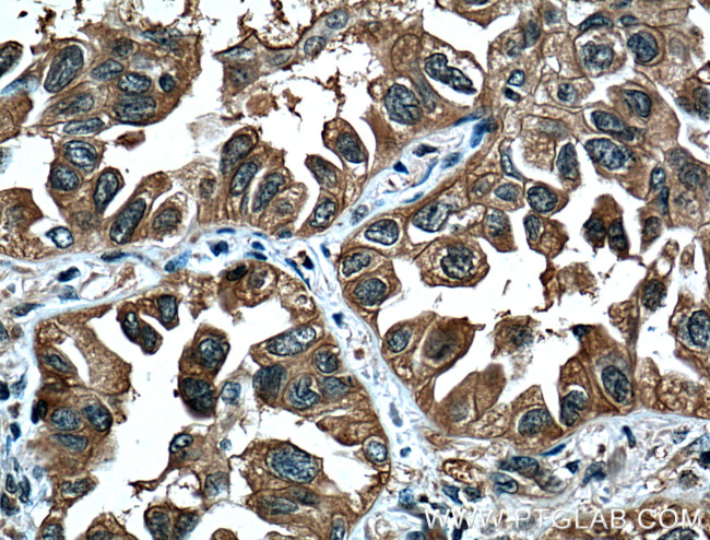 14-3-3 Antibody in Immunohistochemistry (Paraffin) (IHC (P))