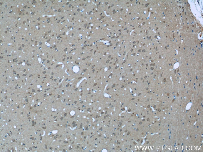 14-3-3 Antibody in Immunohistochemistry (Paraffin) (IHC (P))