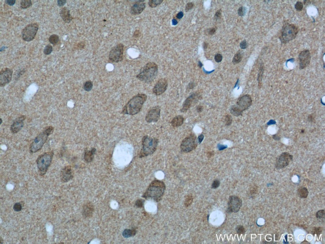 14-3-3 Antibody in Immunohistochemistry (Paraffin) (IHC (P))