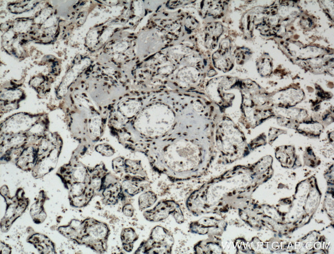 NTF2 Antibody in Immunohistochemistry (Paraffin) (IHC (P))