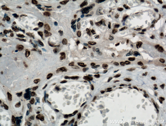 NTF2 Antibody in Immunohistochemistry (Paraffin) (IHC (P))