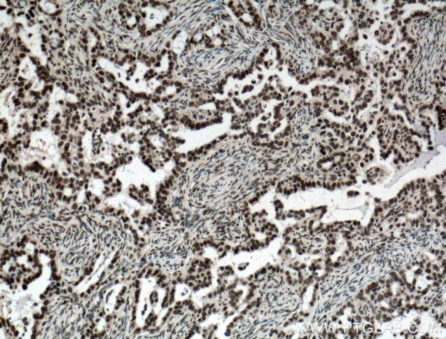 NTF2 Antibody in Immunohistochemistry (Paraffin) (IHC (P))