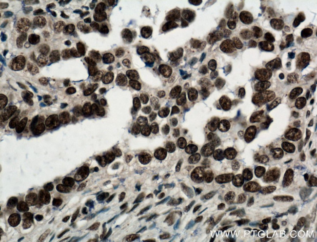 NTF2 Antibody in Immunohistochemistry (Paraffin) (IHC (P))