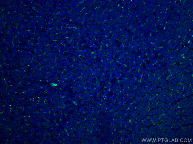 CD31 Antibody in Immunohistochemistry (Paraffin) (IHC (P))