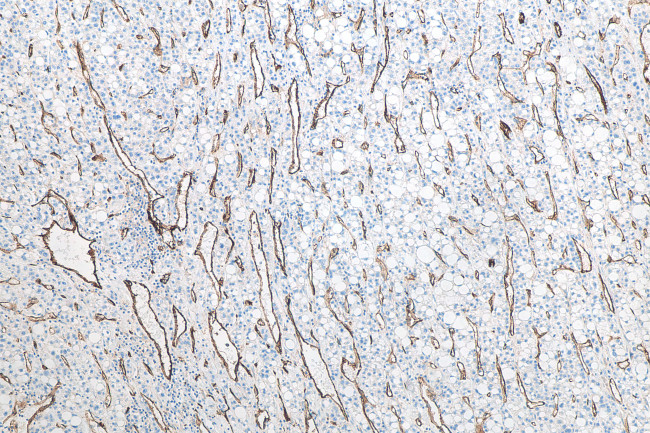 CD31 Antibody in Immunohistochemistry (Paraffin) (IHC (P))