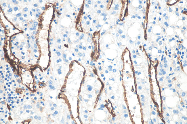 CD31 Antibody in Immunohistochemistry (Paraffin) (IHC (P))