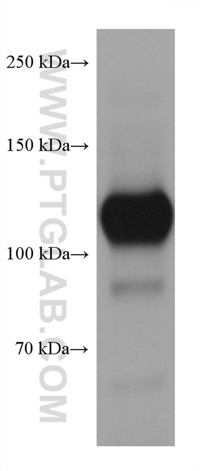 CD31 Antibody in Western Blot (WB)