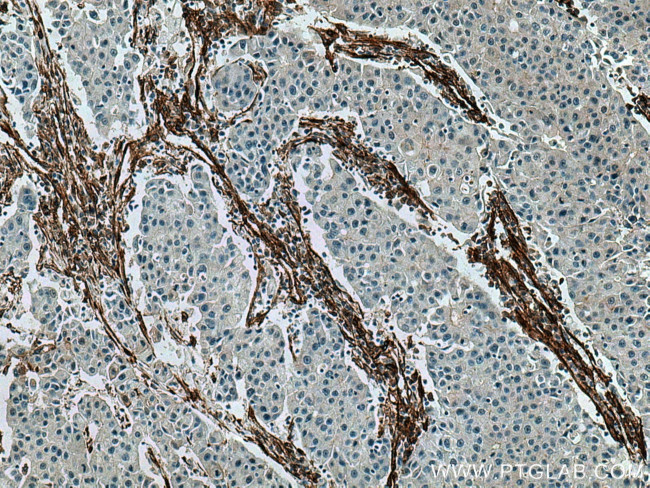 Caveolin-1 Antibody in Immunohistochemistry (Paraffin) (IHC (P))