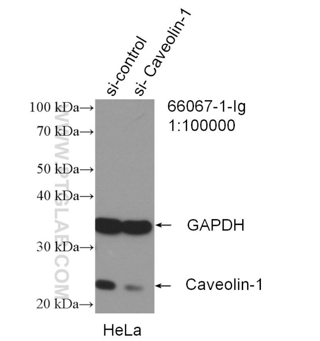 Caveolin-1 Antibody in Western Blot (WB)