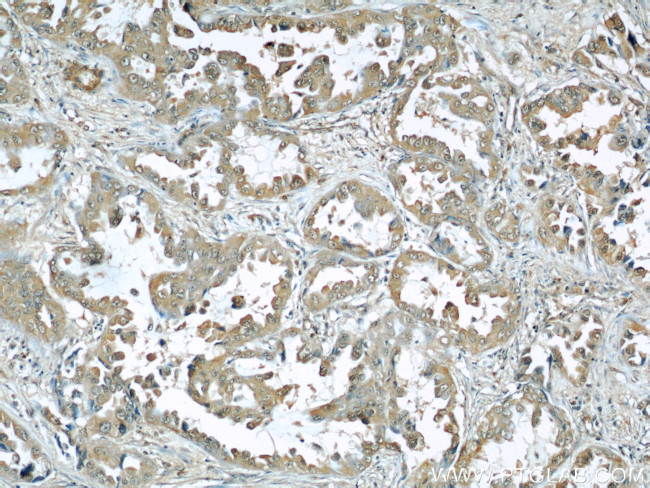 Caveolin-1 Antibody in Immunohistochemistry (Paraffin) (IHC (P))