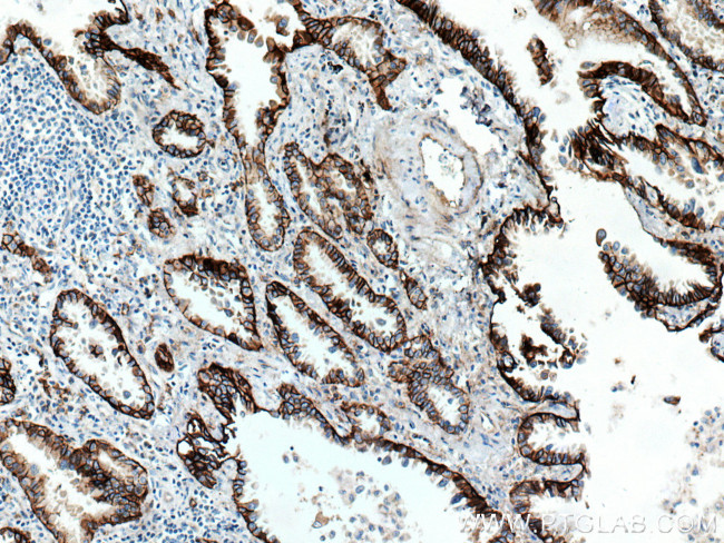 Integrin alpha-3 Antibody in Immunohistochemistry (Paraffin) (IHC (P))