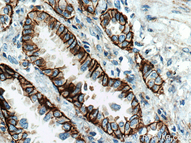 Integrin alpha-3 Antibody in Immunohistochemistry (Paraffin) (IHC (P))