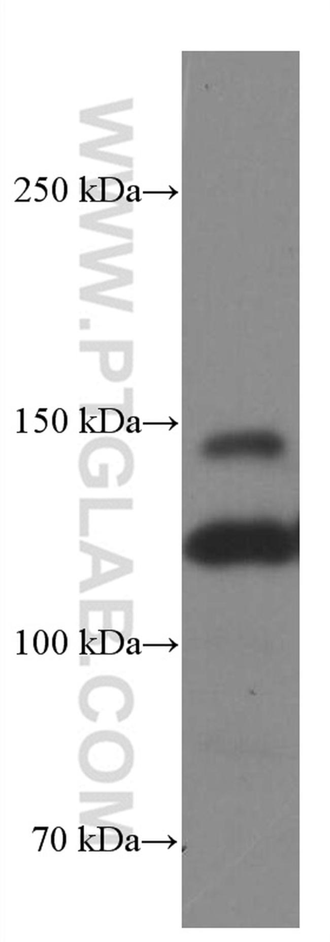 Integrin alpha-3 Antibody in Western Blot (WB)