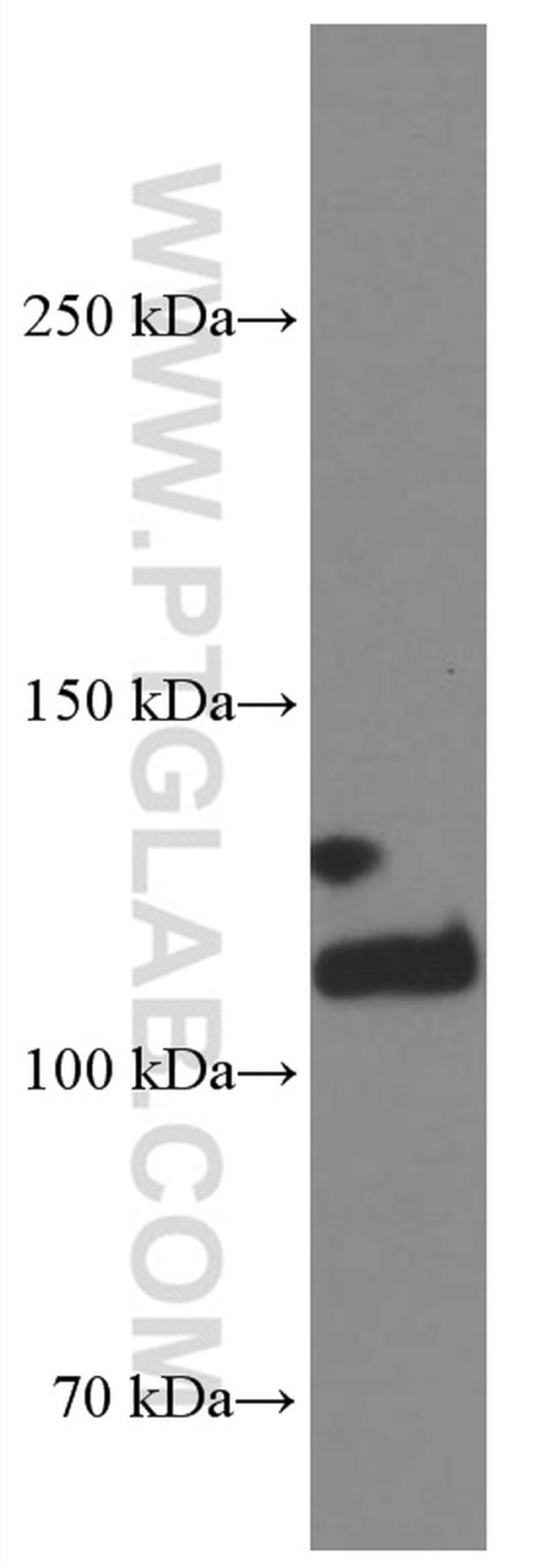 Integrin alpha-3 Antibody in Western Blot (WB)