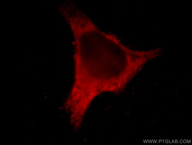 EPLIN Antibody in Immunocytochemistry (ICC/IF)