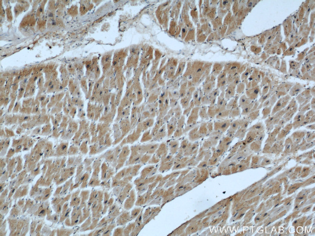 EPLIN Antibody in Immunohistochemistry (Paraffin) (IHC (P))