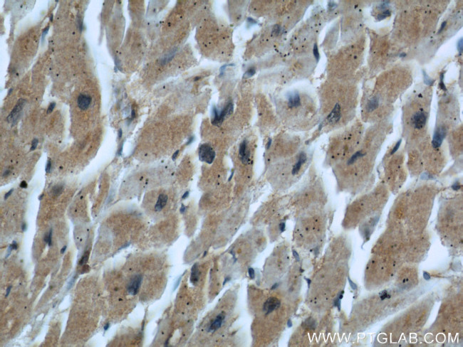 EPLIN Antibody in Immunohistochemistry (Paraffin) (IHC (P))