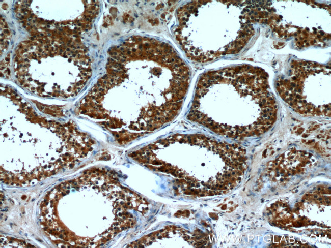 CPT1C Antibody in Immunohistochemistry (Paraffin) (IHC (P))