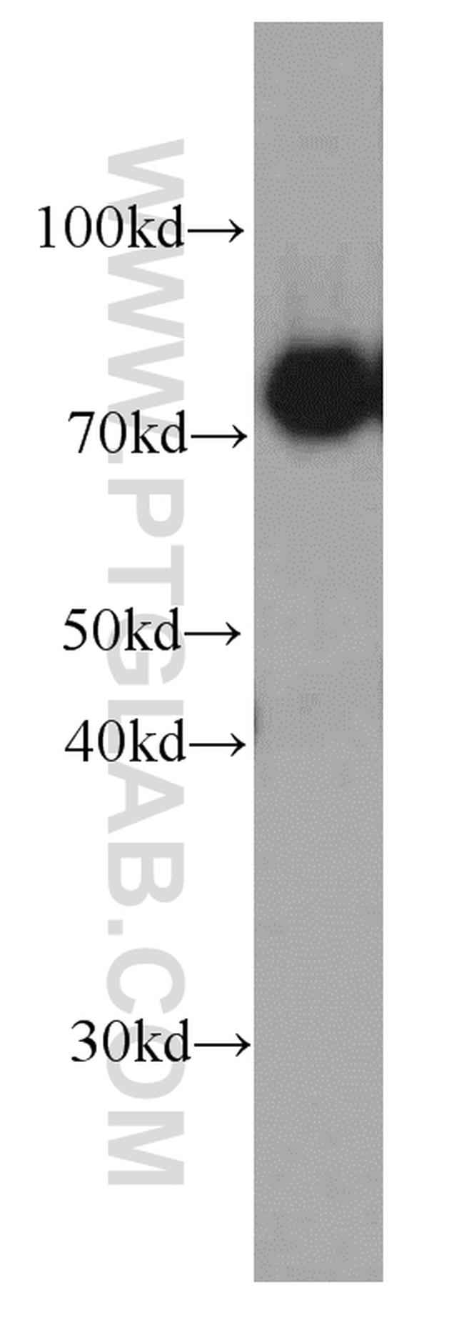 CPT1C Antibody in Western Blot (WB)