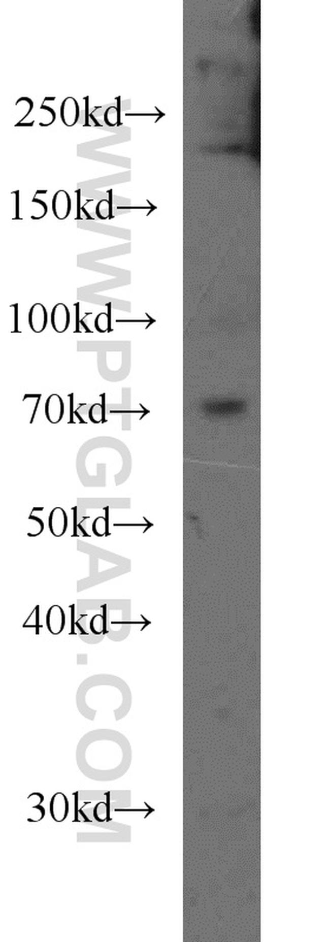 CPT1C Antibody in Western Blot (WB)