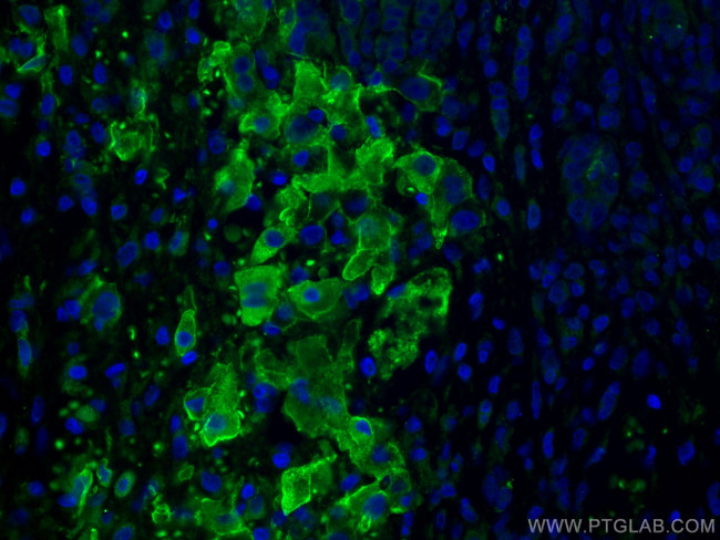 Apolipoprotein H Antibody in Immunohistochemistry (PFA fixed) (IHC (PFA))