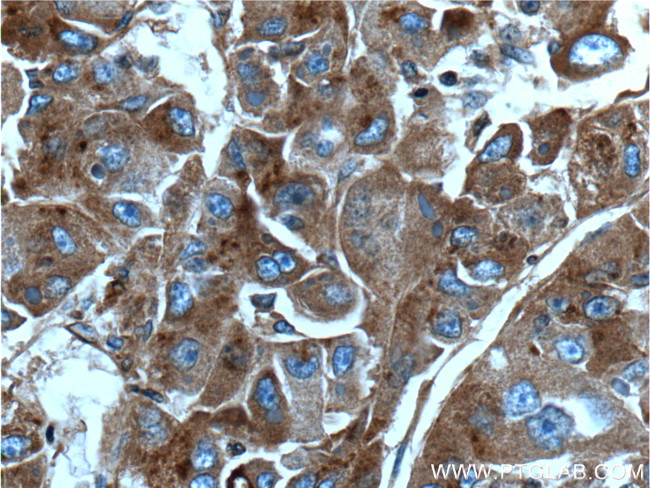 Apolipoprotein H Antibody in Immunohistochemistry (Paraffin) (IHC (P))