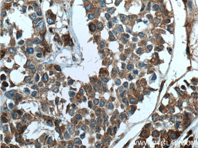 Apolipoprotein H Antibody in Immunohistochemistry (Paraffin) (IHC (P))